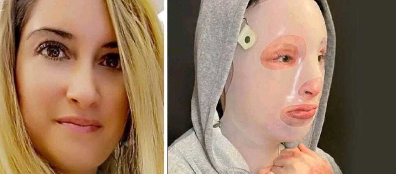 Επίθεση με βιτριόλι: Αρχίζει σήμερα η δίκη - Θα παραστεί και η Ιωάννα Παλιοσπύρου